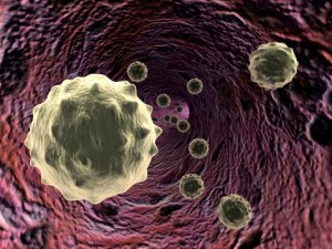 Tainted Scopes Cause Deadly Superbug Infections