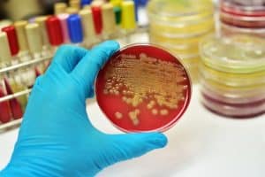toddlers-death-from-a-fatal-e-coli-infection-could-have-been-prevented