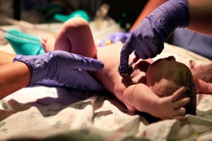 Maternal Mortality Rate on the Rise in the U.S.