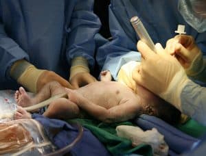 Delivery Room Dangers: Unnecessary Episiotomy Procedures