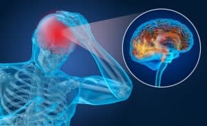Domestic Abuse Victims Have Shocking Rate of Concussions
