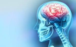 Hemorrhagic stroke