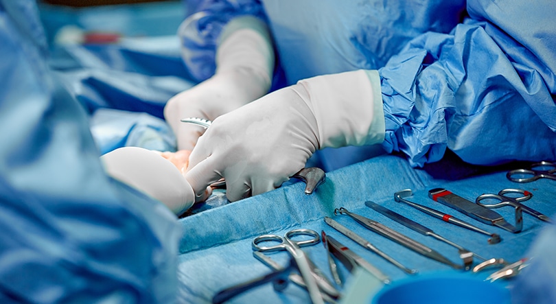 Forceps